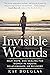 Invisible Wounds: Help, Hop...