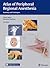 Atlas of Peripheral Regional Anesthesia by Gisela Meier