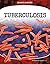 Tuberculosis