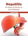 Hepatitis: An Issue of Clinics in Liver Disease Hepatitis: An Issue of Clinics in Liver Disease
