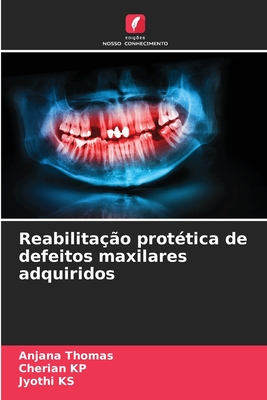Reabilitação protética de defeitos maxilares adquiridos (Portuguese Edition)