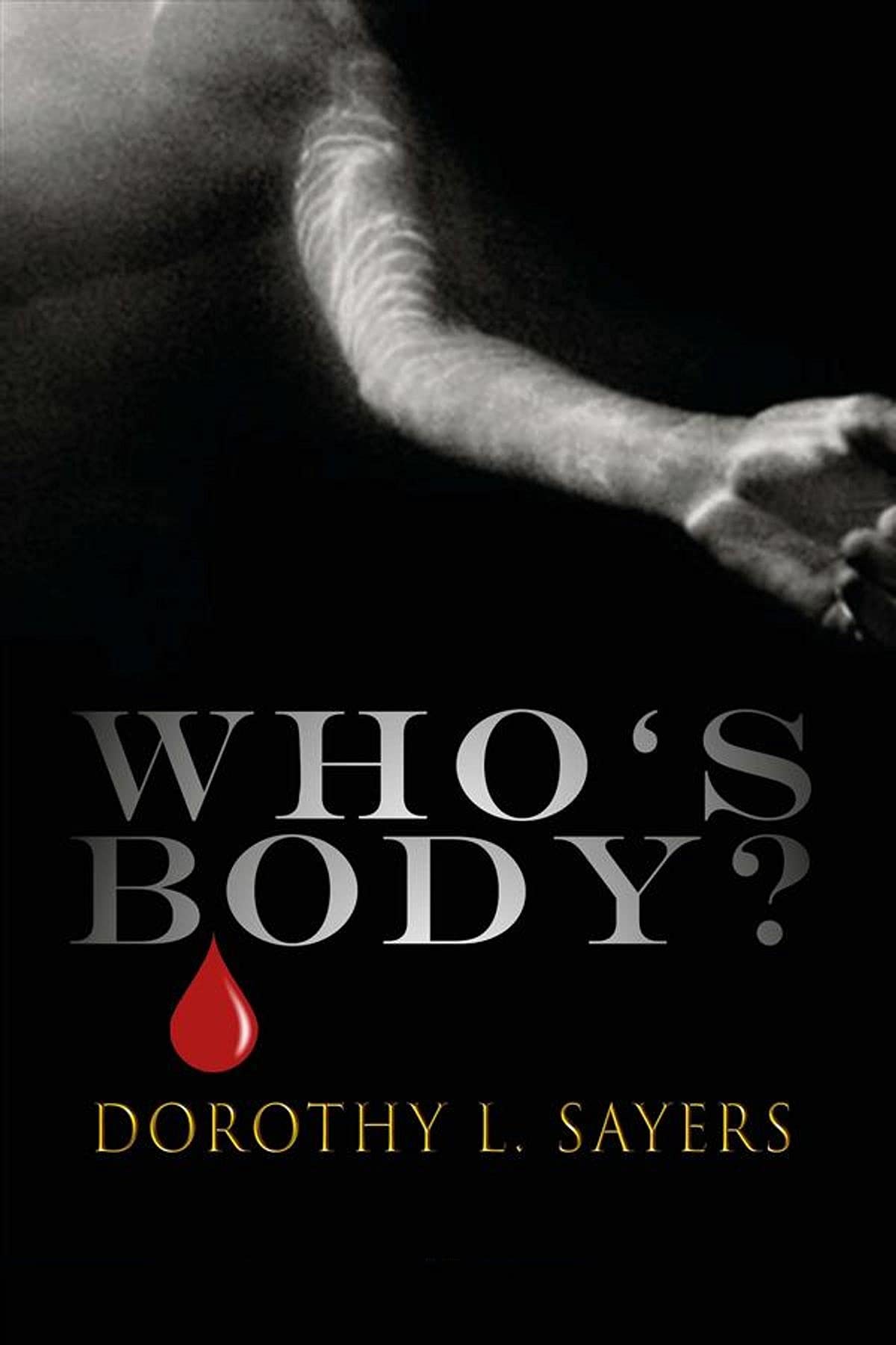 Whose Body?