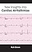 New Insights Into Cardiac Arrhythmias by Ruth    Brown