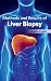 Methods and Results of Liver Biopsy by Amelia Foster