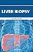 Liver Biopsy