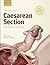 Textbook of Caesarean Section