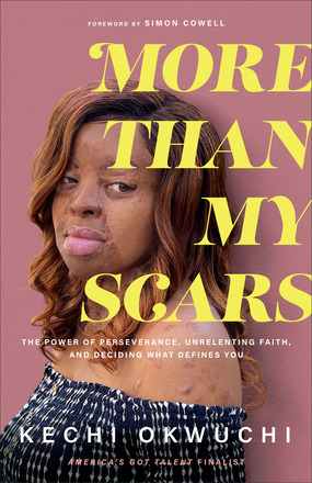 More Than My Scars: The Power of Perseverance, Unrelenting Faith, and Deciding What Defines You (Paperback)