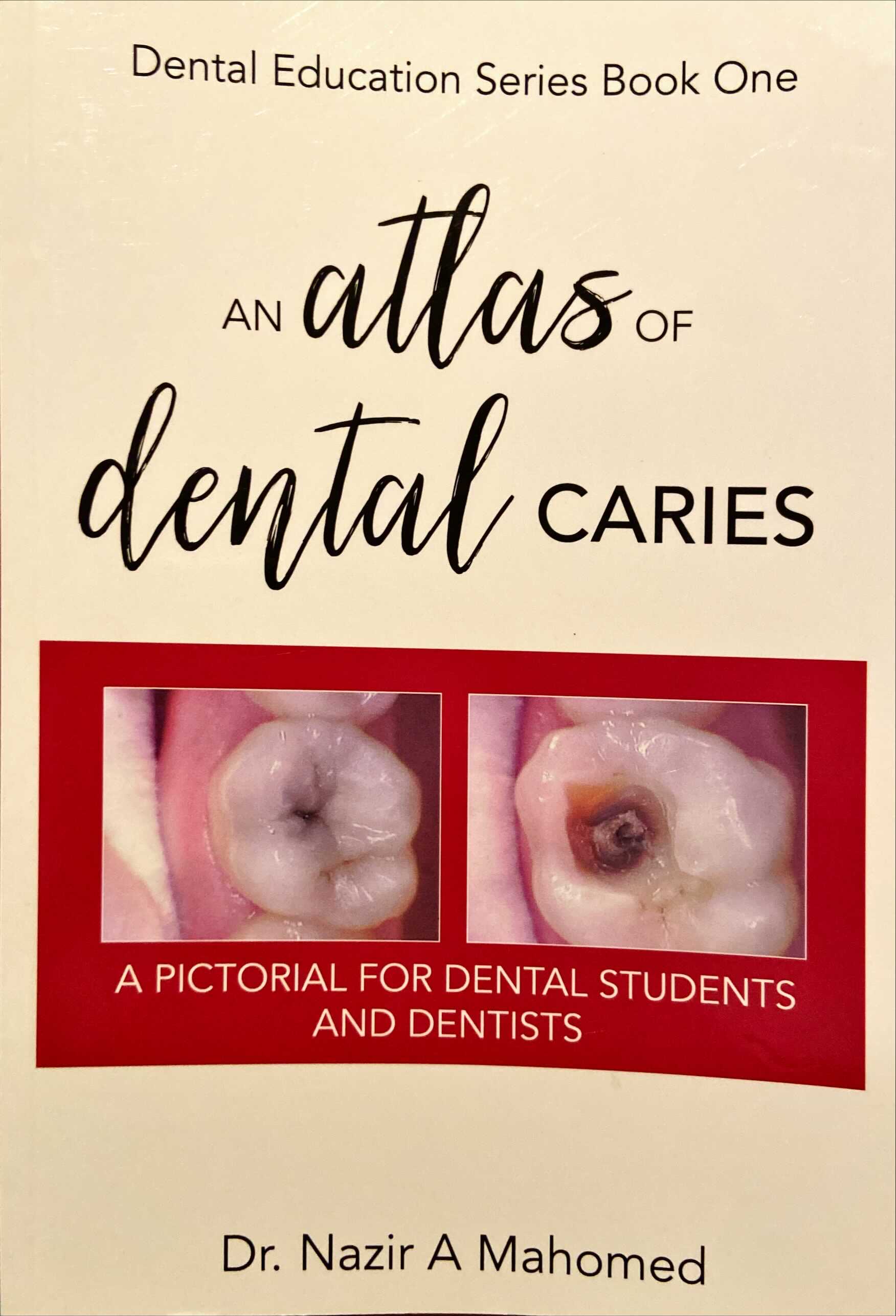 An Atlas of Dental Caries (Dental Education Series, #1)