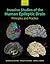 Invasive Studies of the Human Epileptic Brain: Principles and Practice