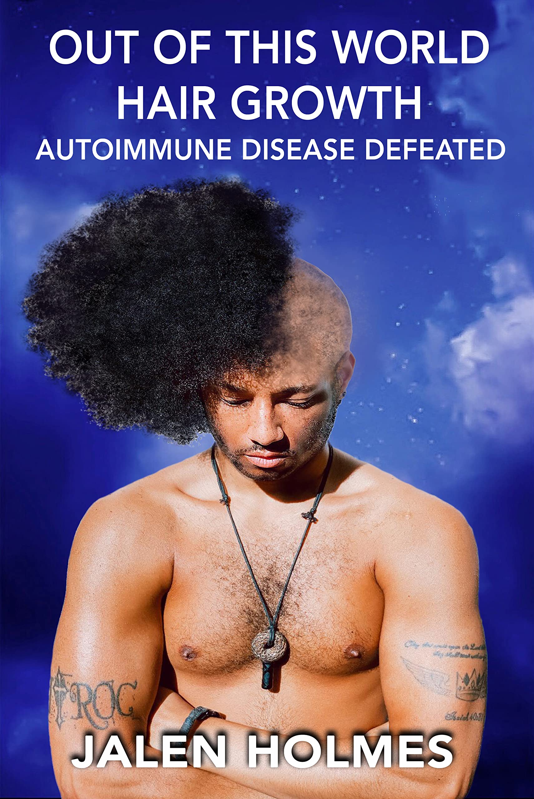 Out Of This World Hair Growth: Autoimmune Disease Defeated (Kindle Edition)