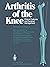 Arthritis of the Knee: Clin...