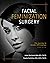 Facial Feminization Surgery...
