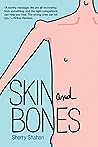 Skin and Bones