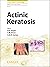 Actinic Keratosis (Current Problems in Dermatology Book 46)