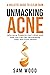 Unmasking Acne by Sam Wood