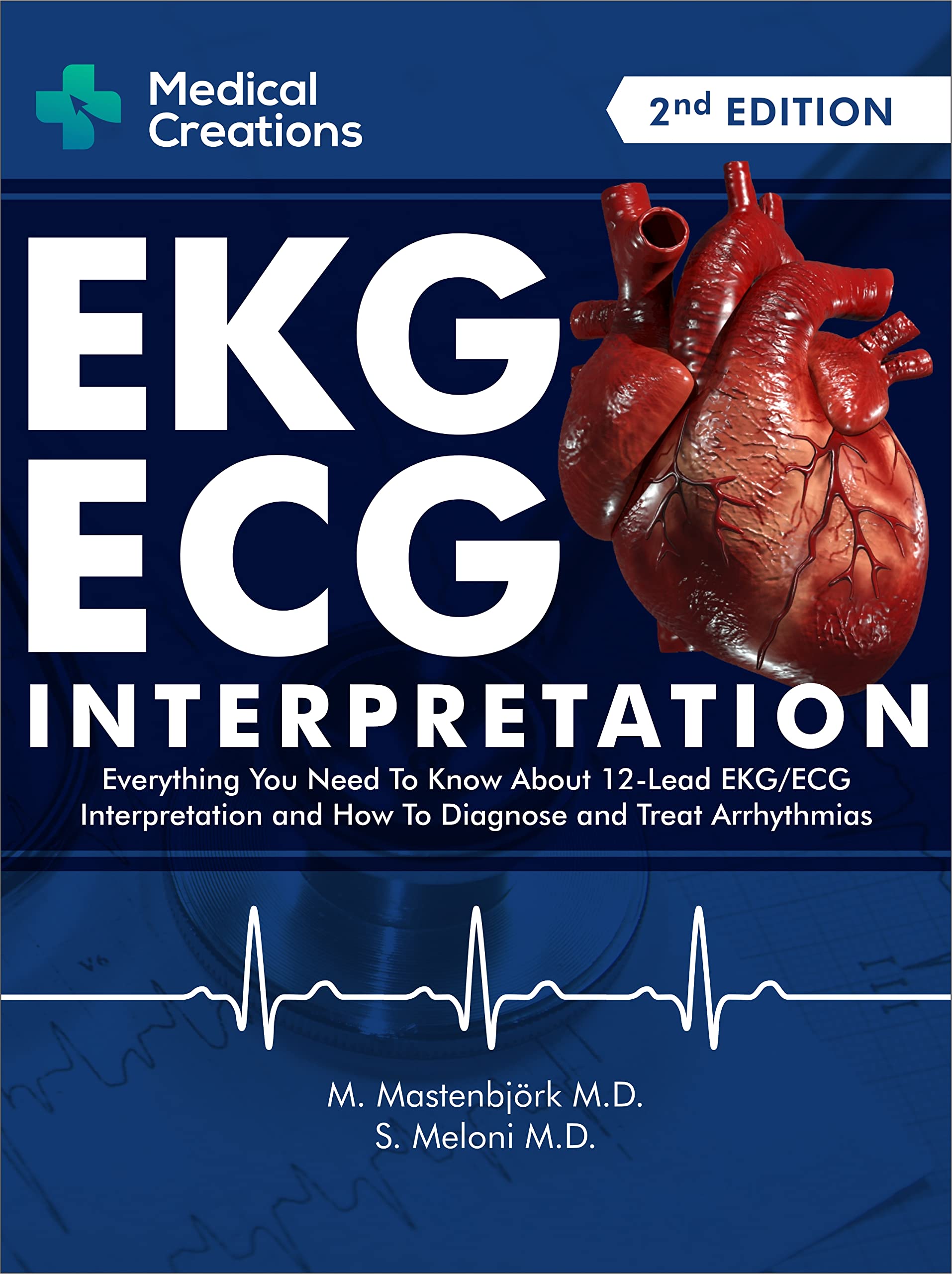 EKG/ECG Interpretation: Everything you Need to Know about the 12 - Lead ECG/EKG Interpretation and How to Diagnose and Treat Arrhythmias: 2nd Edition (Kindle Edition)