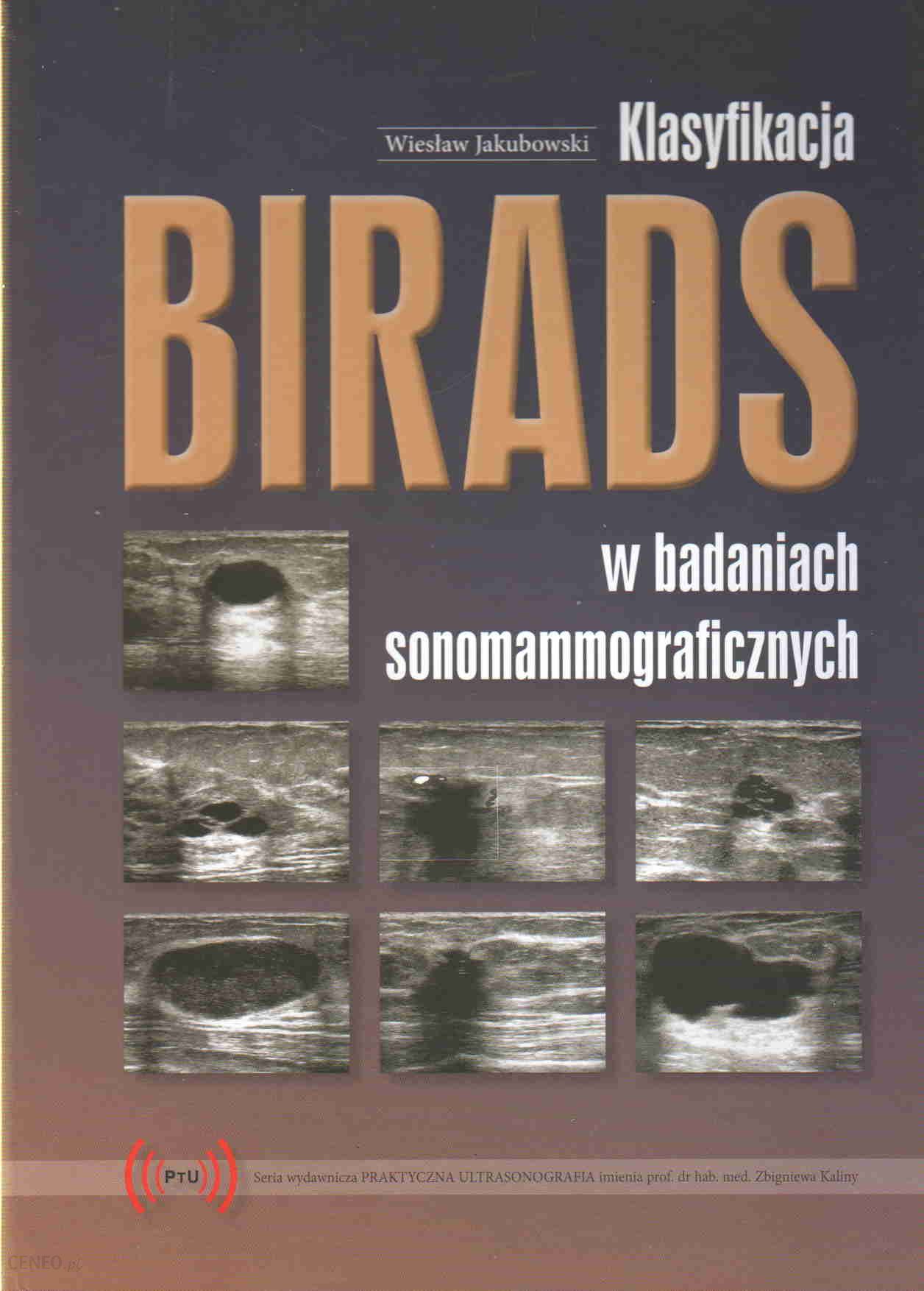 Klasyfikacja BIRADS w badaniach sonomammograficznych