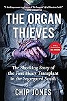 The Organ Thieves by Chip Jones