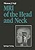 MRI of the Head and Neck by Thomas J. Vogl