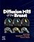 DIFFUSION MRI OF THE BREAST...