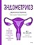 Эндометриоз. Как разобраться в причинах, распознать симптомы и позаботиться о себе в повседневной жизни