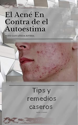 El acné en contra de el autoestima: Tips y remedios caseros (Spanish Edition)