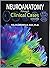 Neuroanatomy through Clinical Cases by Hal Blumenfeld
