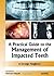 A practical guide to mangement of impacted tooth
