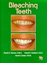 Bleaching Teeth