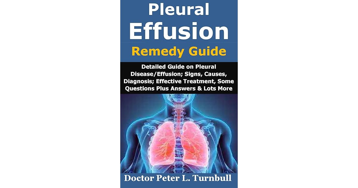 Pleural Effusion Remedy Guide Detailed Guide on Pleural Disease/Effusion; Signs, Causes
