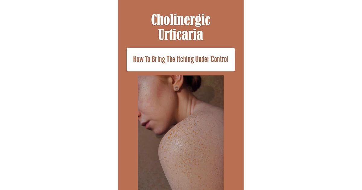 Cholinergic Urticaria How To Bring The Itching Under Control by Buford