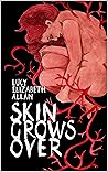 Skin Grows Over Skin Grows Over