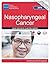 NCCN Guidelines for Patients® Nasopharyngeal Cancer