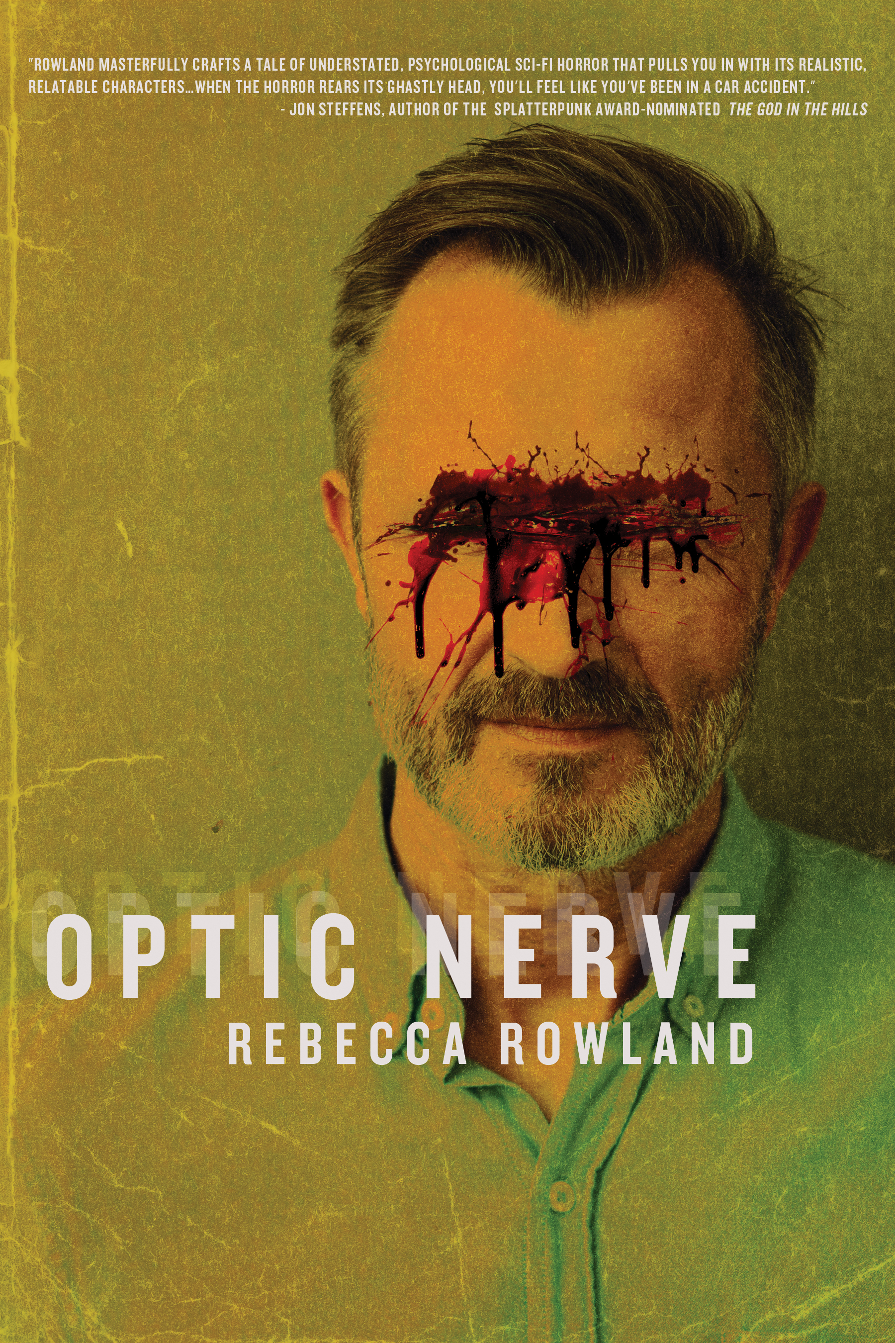 Optic Nerve
