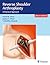 Reverse Shoulder Arthroplasty: A Practical Approach