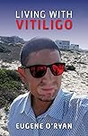 Living with Vitiligo by Eugene O'Ryan