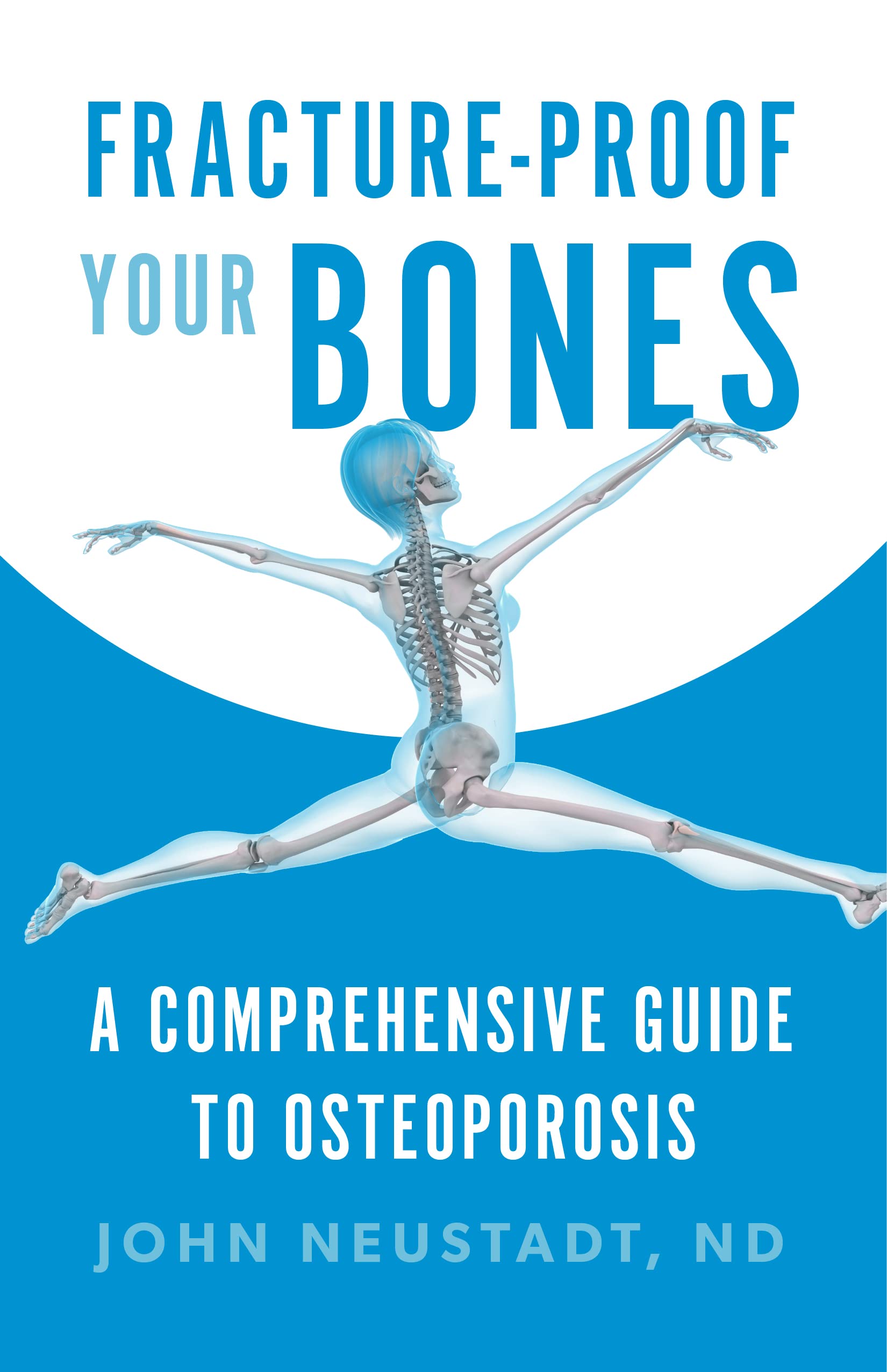 Fracture-Proof Your Bones: A Comprehensive Guide to Osteoporosis (Kindle Edition)