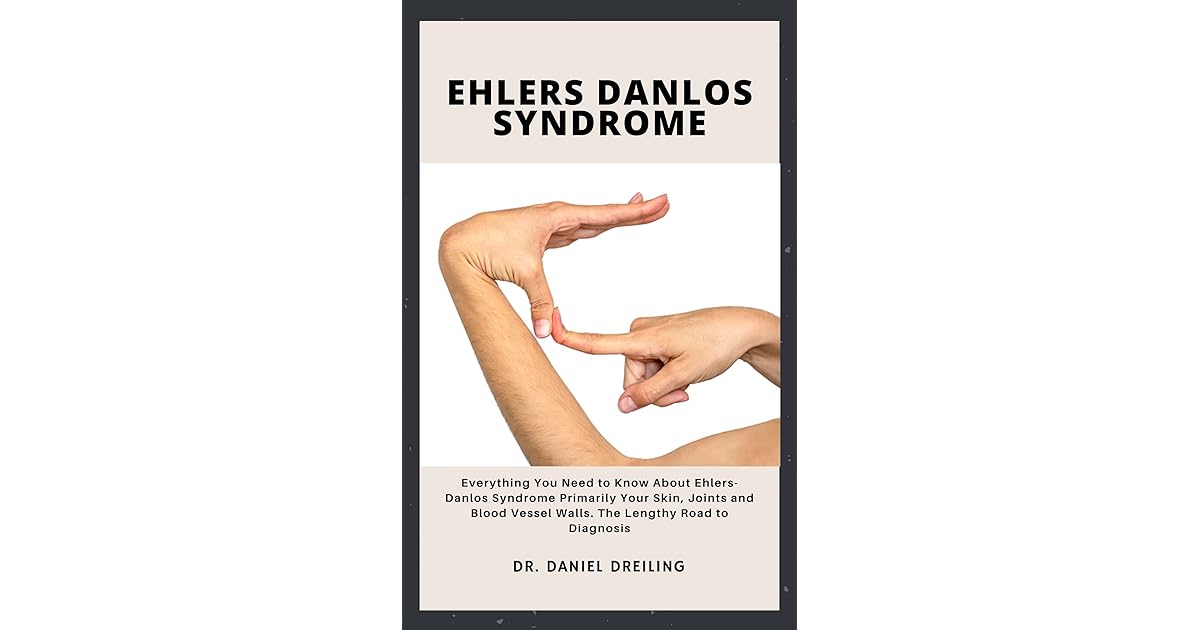 EHLERS DANLOS SYNDROME Everything You Need to Know About EhlersDanlos