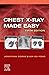 Chest X-Ray Made Easy E-Book