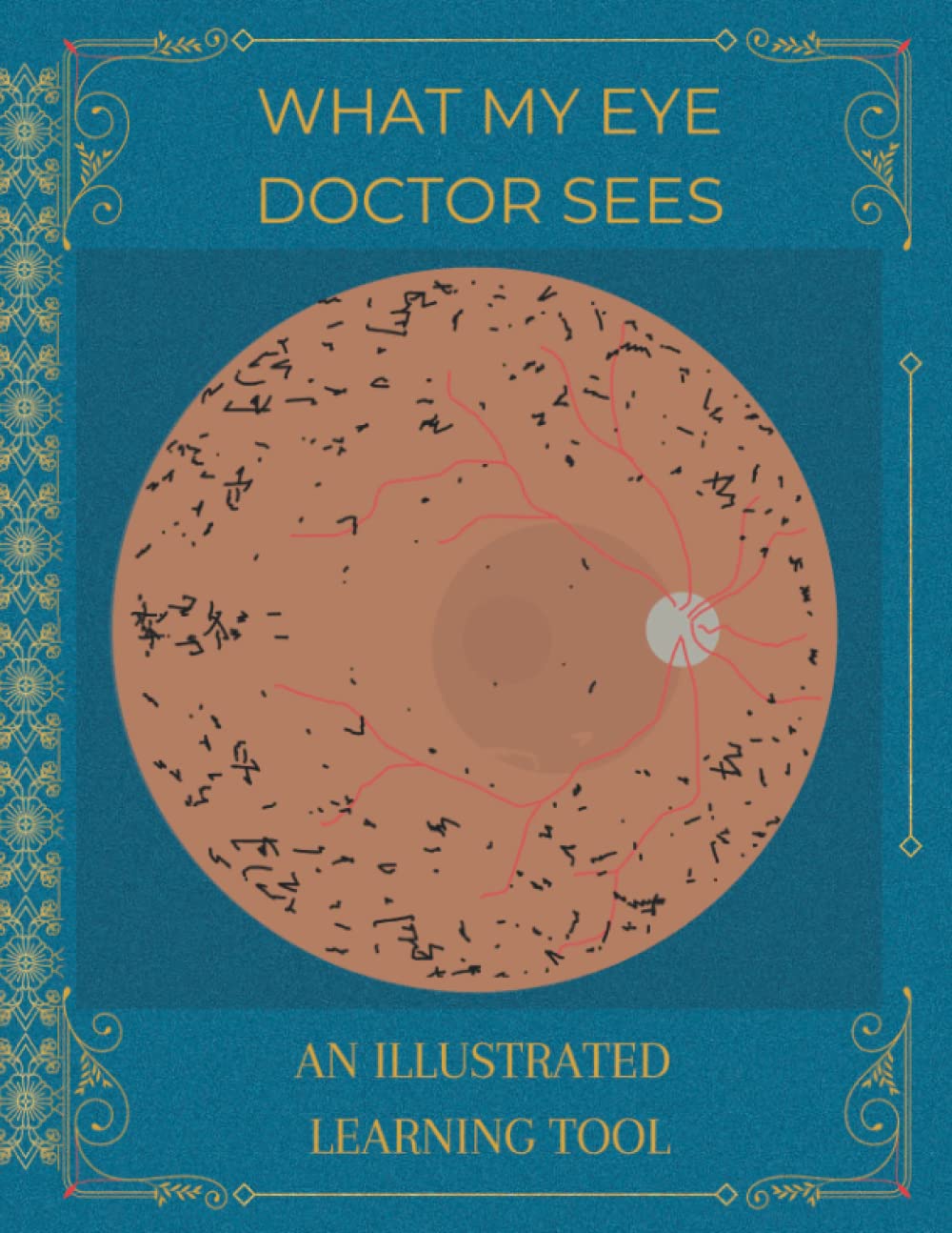 What My Eye Doctor Sees: An Illustrated Learning Tool: A Great Resource for Curious Patients and Students (7th thru 12th Grade)