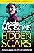 Hidden Scars (DI Kim Stone #17)