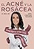El Acné y la Rosácea : Como nunca antes te lo habían explicado (Spanish Edition)