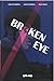 Broken Eye by Martin Etxeberria
