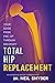Total Hip Replacement: An E...