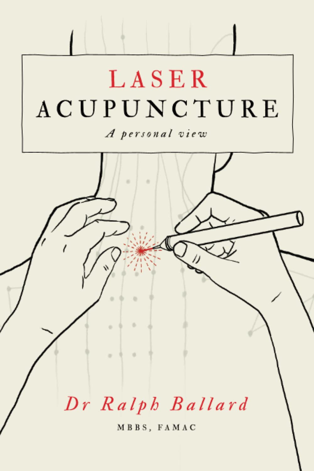 Laser Acupuncture: A personal view (Paperback)