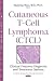 Cutaneous T-cell Lymphoma: Clinical Features, Diagnosis and Treatment Options