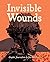 Invisible Wounds: Interview...