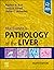 MacSween's Pathology of the Liver, E-Book