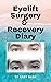 Eyelift Surgery and Recovery Diary by Kady Dash