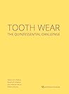 Tooth Wear: The Q...